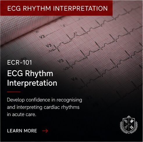 rhythm